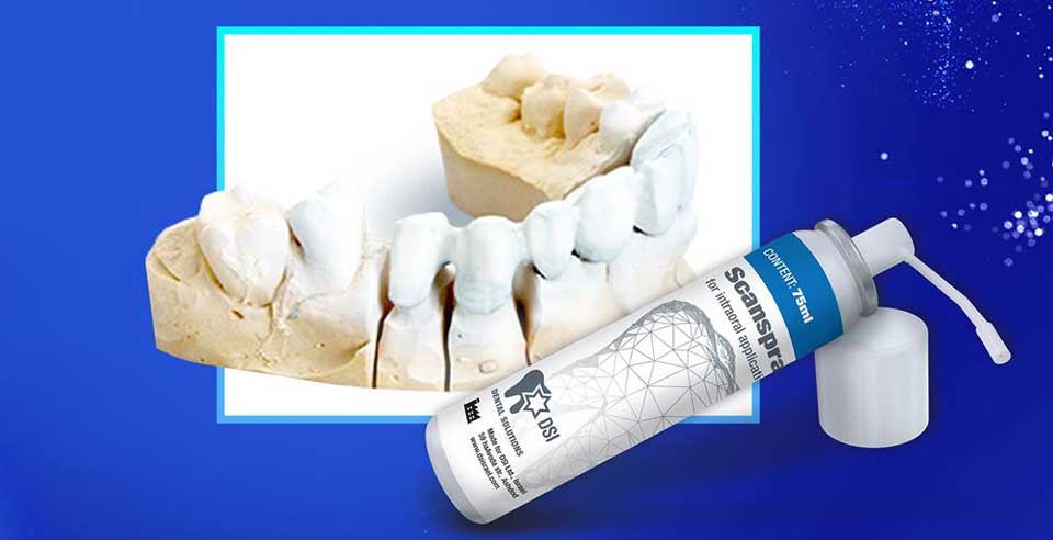Scanspray- Complex geometries and detailed reproduction of tooth margins