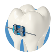Orthodontics Supplies