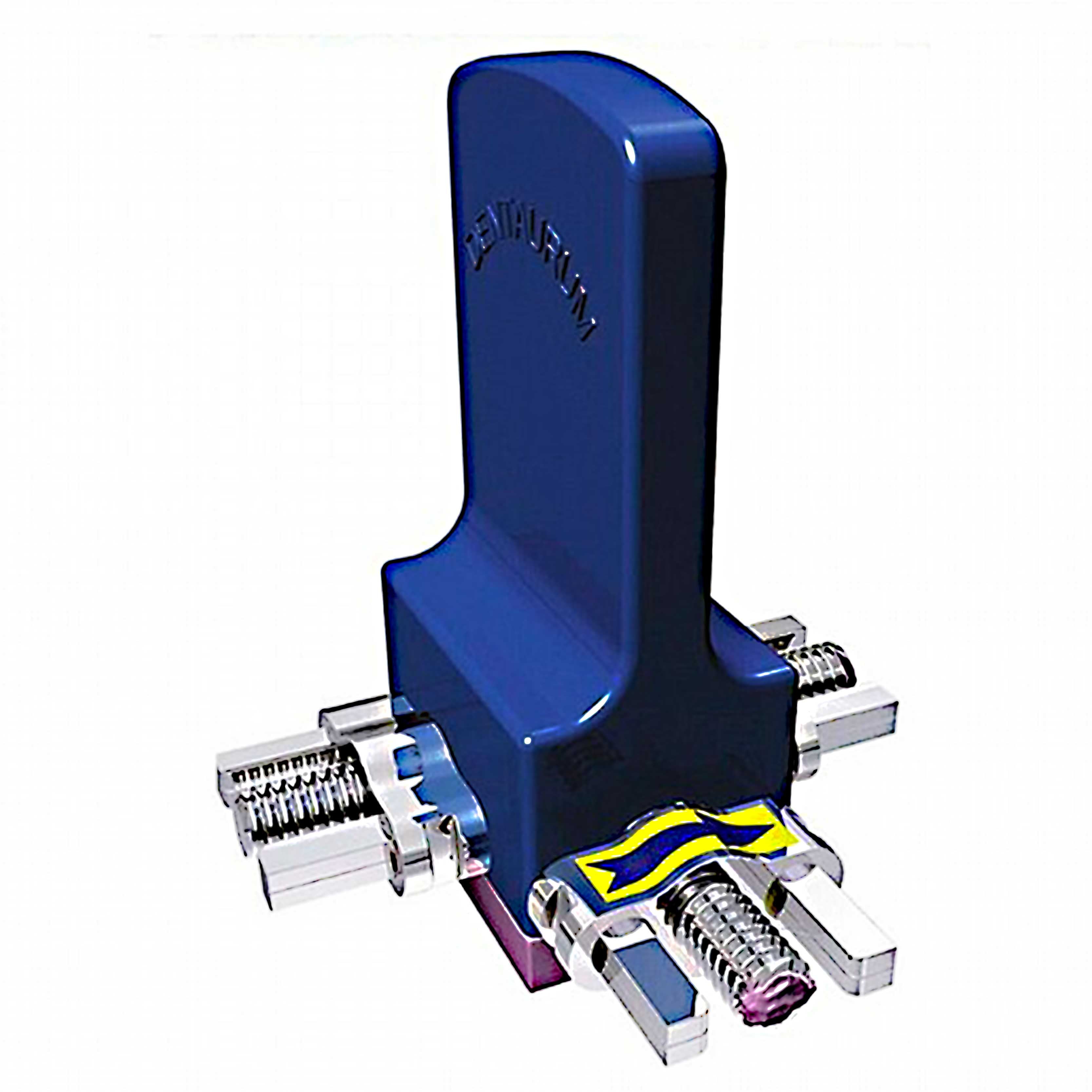 Dentaurum Bertoni Three Dimensions Expansion Screw