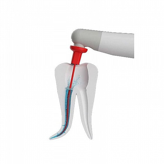 Endodontic Activator for Root Canal Cleaning and Irrigating