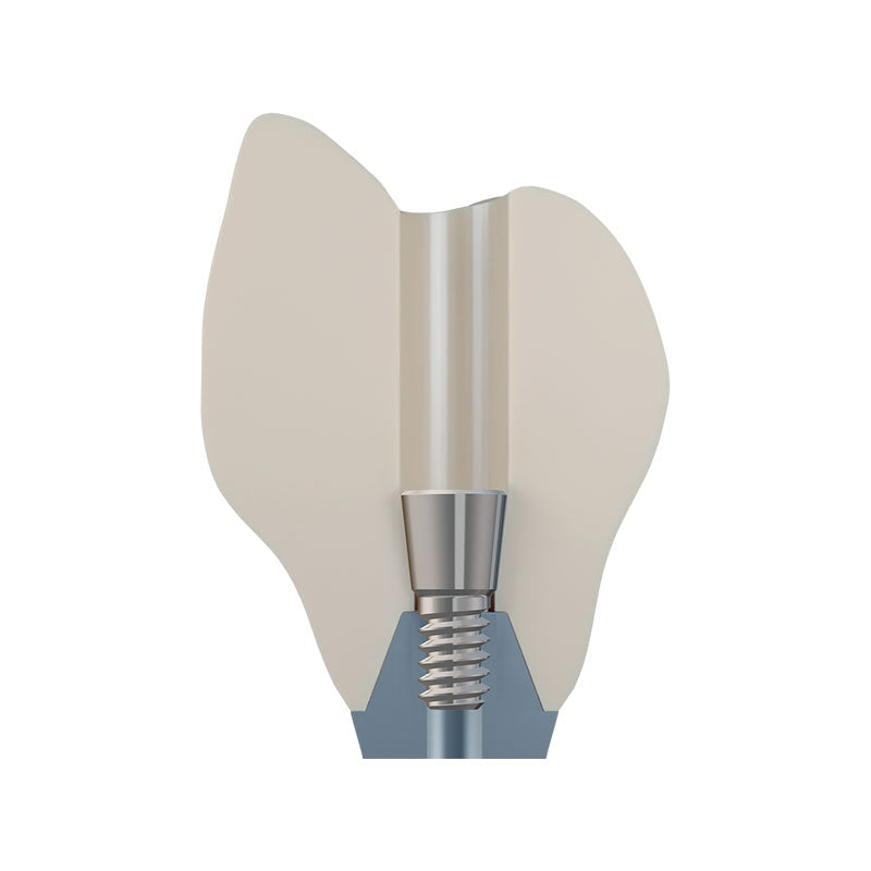 DSI EvoConnect - Direct Сonnection Screws for Multi-Unit Abutments M1.6