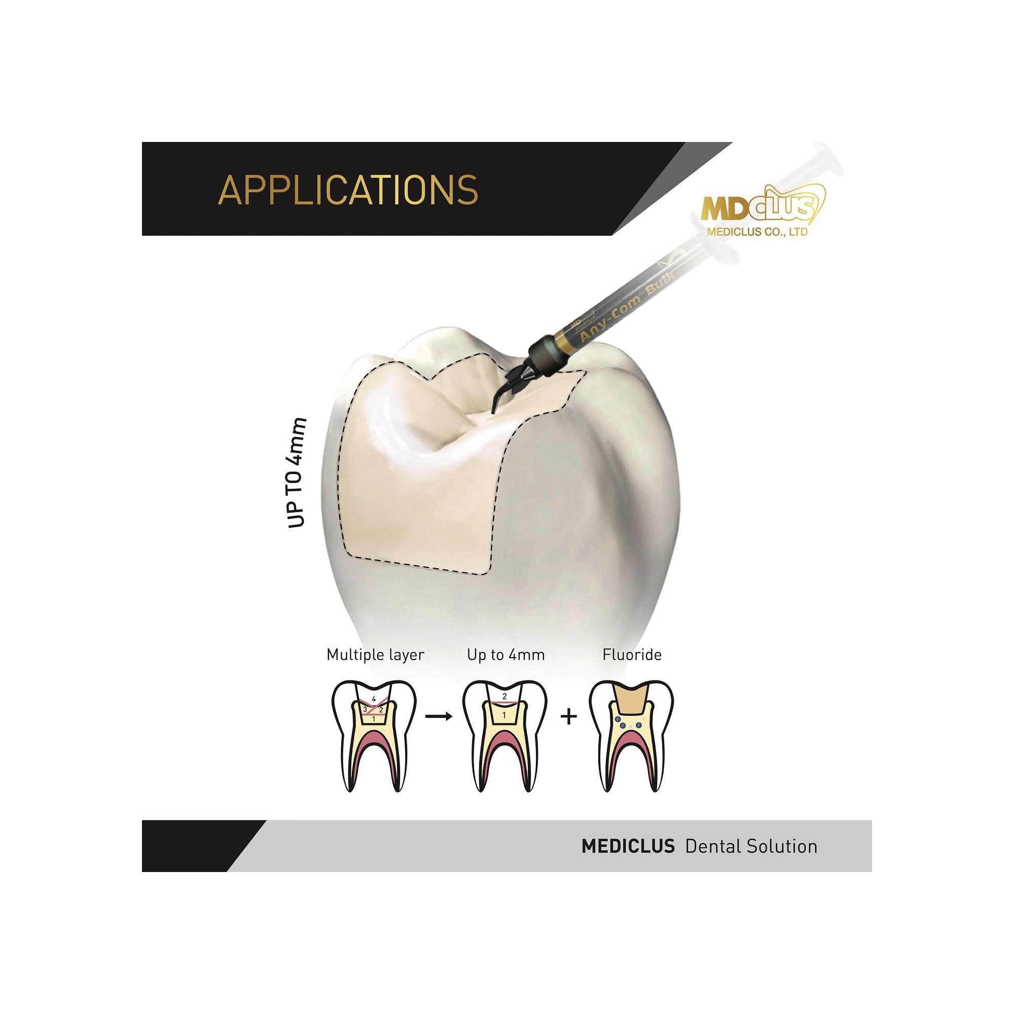 MEDICLUS Any-Com Bulk Flowable Composite in Syringe 2g