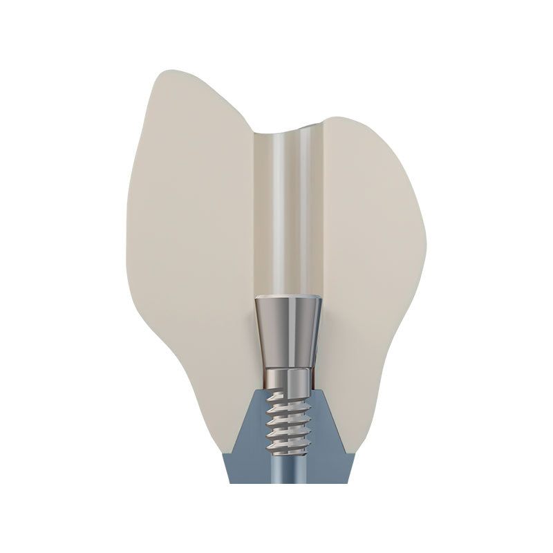 DSI EvoConnect - Direct Сonnection Screws for Multi-Unit Abutments M1.4