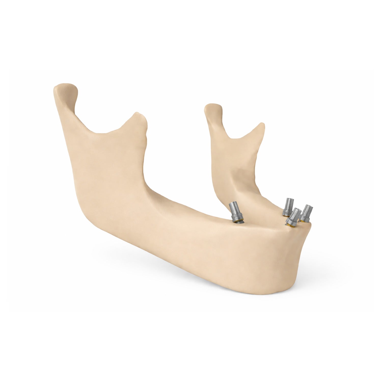 3d Scan Body for Multi-Unit - Surcam® compatible