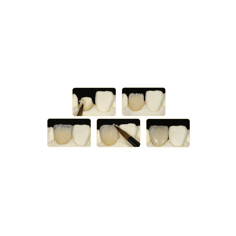GC UNIFAST™ III Self-Curing Acrylic Resin for Temporary Restorations