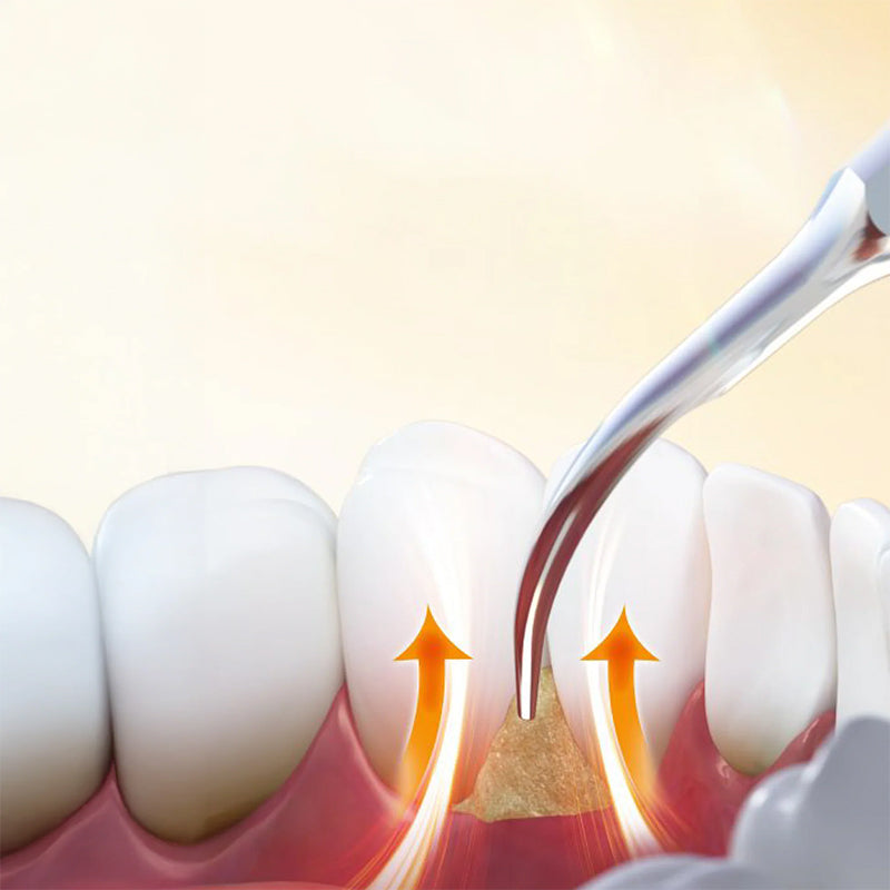 Woodpecker DTE D8 LED Ultrasonic Scaler