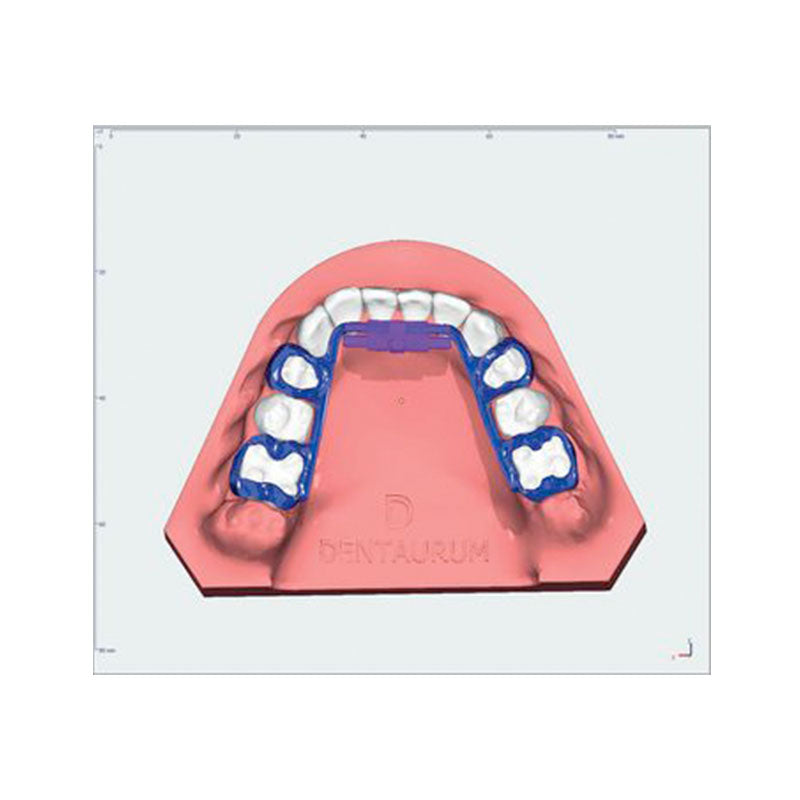 Dentaurum Expansion Variety Click Mini/Maxi without legs