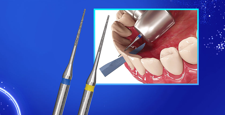 DSI's Ultra-Thin Diamond IPR Burs -  Interproximal Reduction