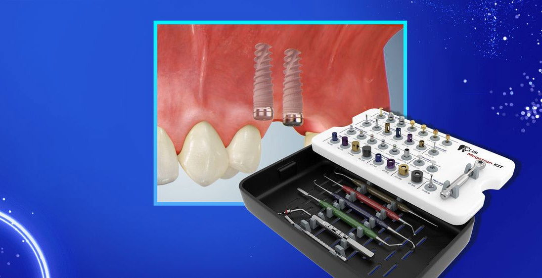DSI Megatron Kit- Creating a Solid Foundation for Implant Placement
