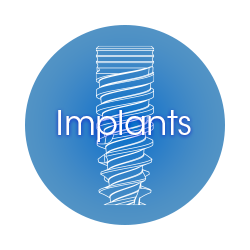Implant Types