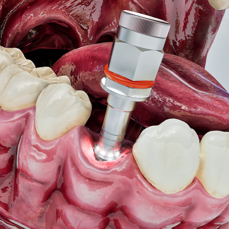 Implight Light-Guided Ratchet Driver