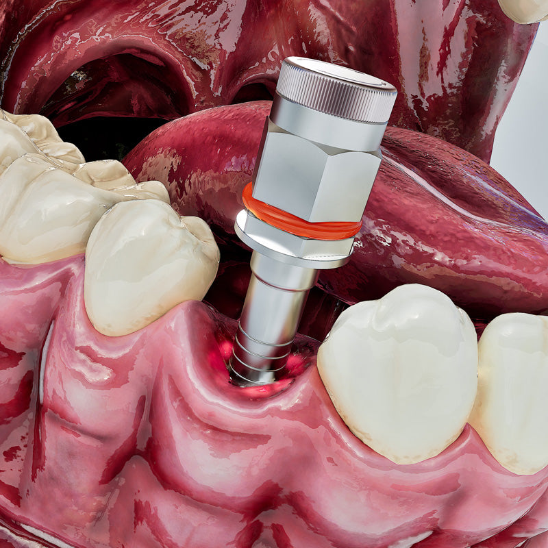 Implight Light-Guided Ratchet Driver