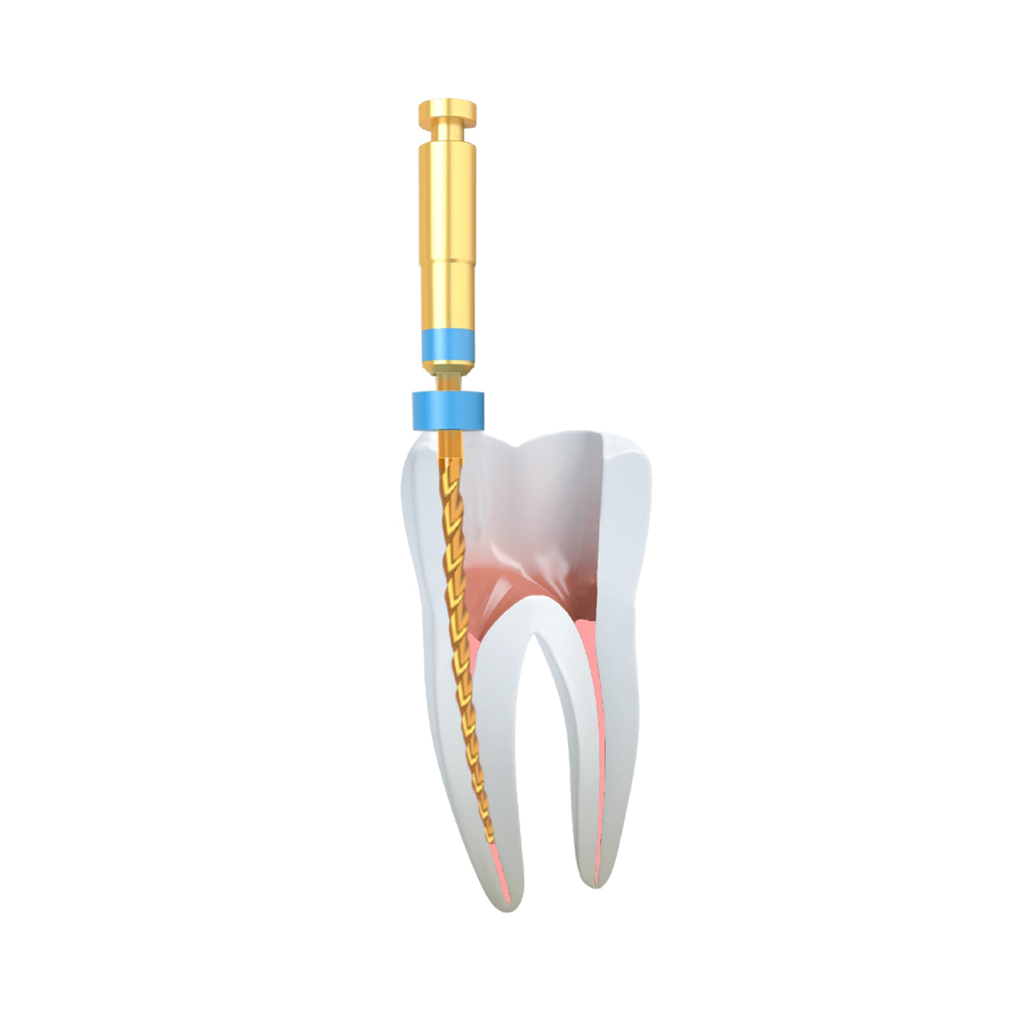 DSI ApexFile Gold Taper Endodontic Rotary Files For Root Canals 6pcs Pack