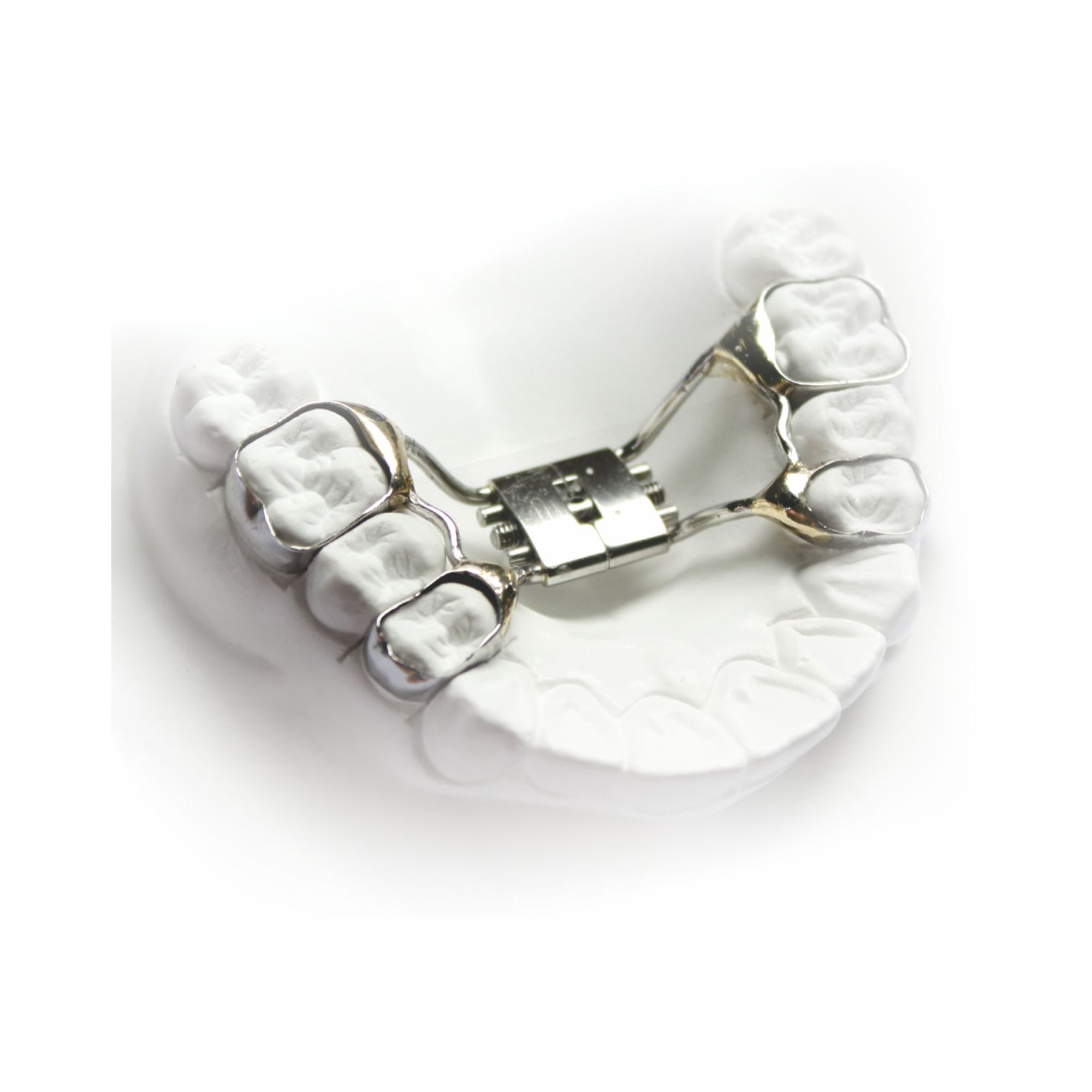 Morelli Palatal Expansion Screw