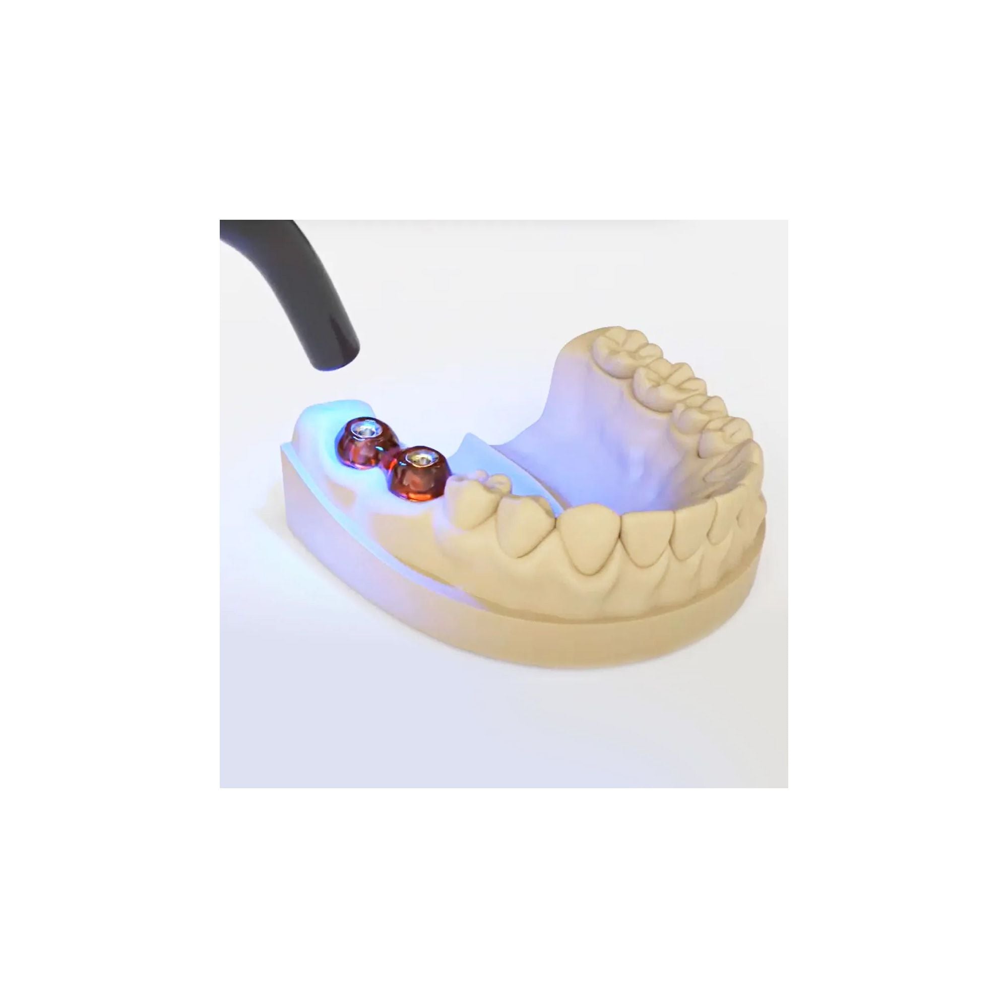 MDCLUS LC Pattern Resin In Syringe 14g