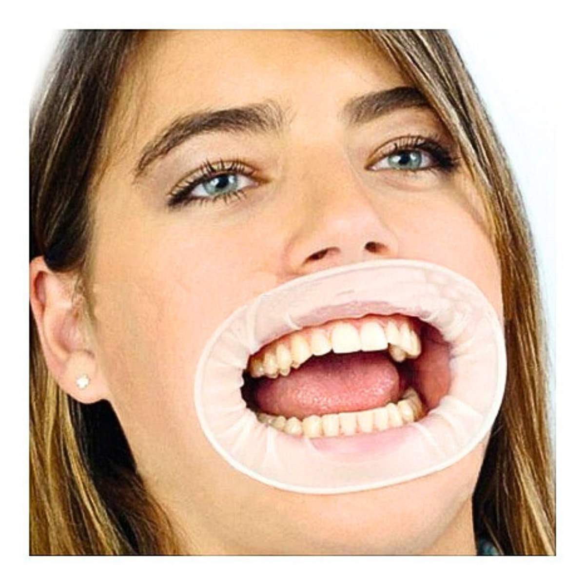 Sterile Gate Disposable Lip Retractor Protector Ring