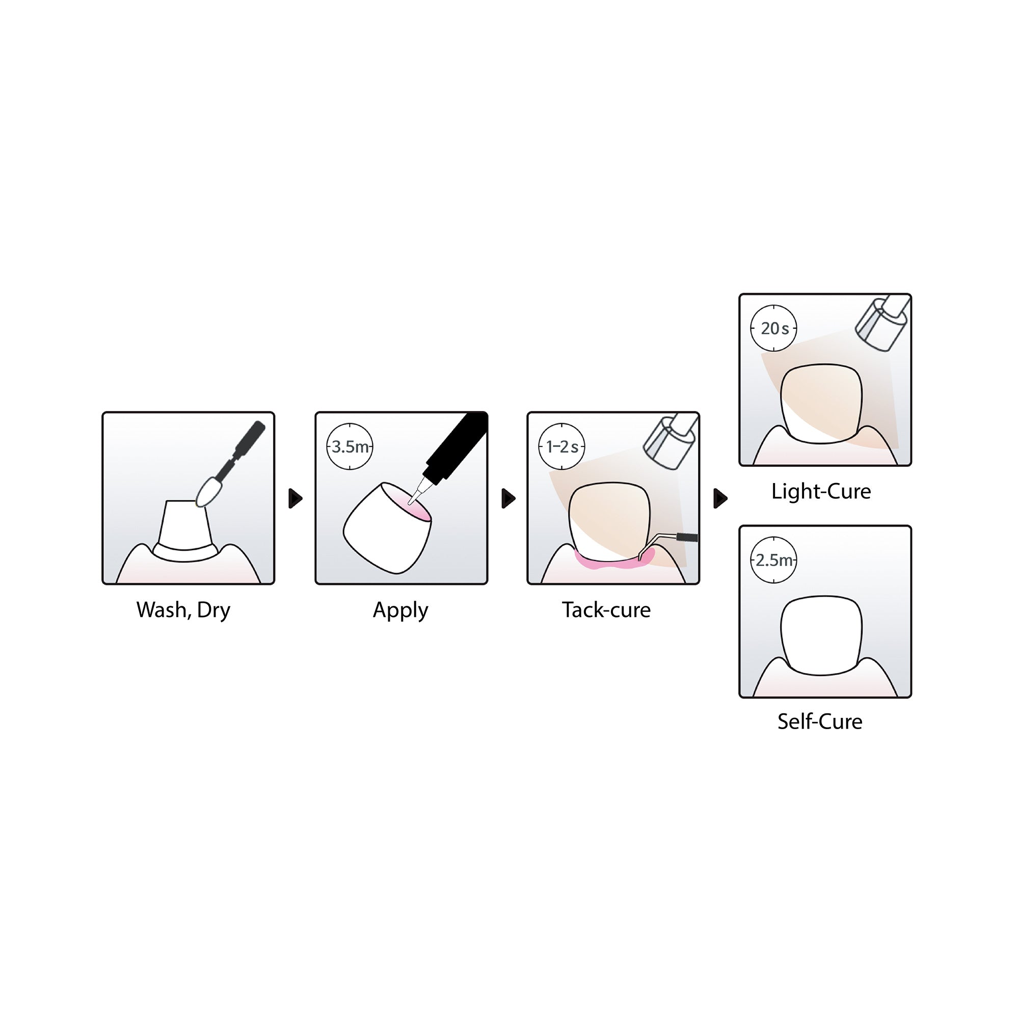 Any-Cem® Universal cement with dual-curing 6g