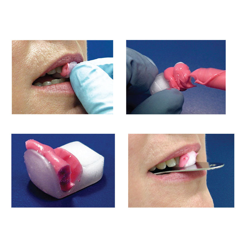 Lucia Jig Anterior Deprogrammer