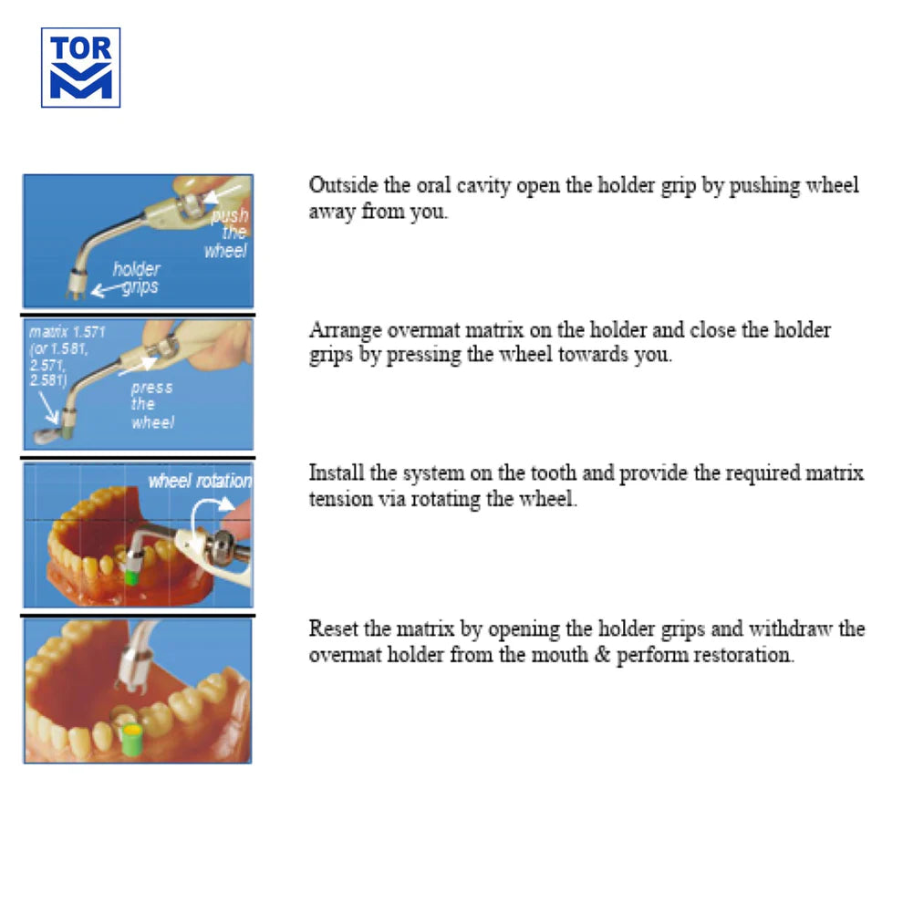 Overmat Matrix System for Molars and Premolars